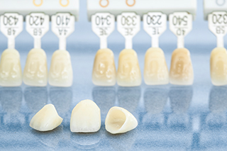 相武台、座間・相武台セントラル歯科・理由3