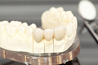 相武台、座間・相武台セントラル歯科・理由3